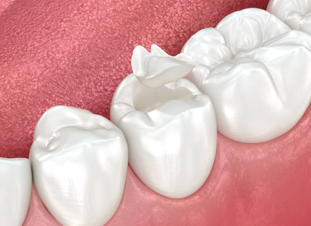 Professional  Dental Services in Burnham, IL